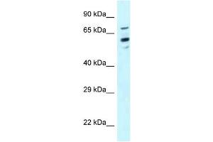 Western Blot showing TOMM70A antibody used at a concentration of 1 ug/ml against Hela Cell Lysate (TOM70 Antikörper  (N-Term))