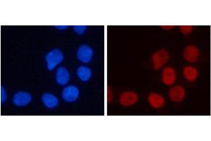Immunofluorescence analysis of 293T cells using TriMethyl-Histone H3-K4 Polyclonal Antibody (Histone 3 Antikörper  (3meLys4))
