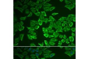 Immunofluorescence analysis of HeLa cells using CRHBP Polyclonal Antibody (CRHBP Antikörper)