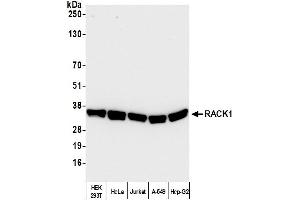 Western Blotting (WB) image for anti-Guanine Nucleotide Binding Protein (G Protein), beta Polypeptide 2-Like 1 (GNB2L1) (AA 1-50) antibody (ABIN7450630)