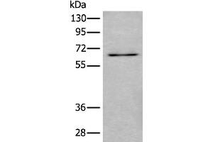 Western blot analysis of SKOV3 cell lysate using UBQLN2 Polyclonal Antibody at dilution of 1:500 (Ubiquilin 2 Antikörper)