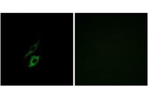 Immunofluorescence analysis of A549 cells, using FPR1 Antibody. (FPR1 Antikörper  (AA 151-200))