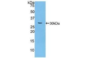 Detection of Recombinant CA125, Mouse using Polyclonal Antibody to Carbohydrate Antigen 125 (CA125) (MUC16 Antikörper  (AA 2-258))