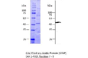 Image no. 3 for Glial Fibrillary Acidic Protein (GFAP) (AA 1-432) protein (Strep Tag) (ABIN3096575) (GFAP Protein (AA 1-432) (Strep Tag))