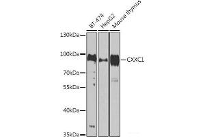 Western blot analysis of extracts of various cell lines using CXXC1 Polyclonal Antibody at dilution of 1:1000. (CXXC1 Antikörper)