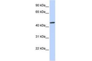 Image no. 1 for anti-Zinc Finger Protein 239 (ZNF239) (AA 108-157) antibody (ABIN6740511) (ZNF239 Antikörper  (AA 108-157))