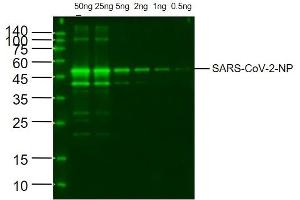 SARS-CoV-2 Nucleocapsid Protein at 0. (SARS-CoV-2 Nucleocapsid Antikörper)