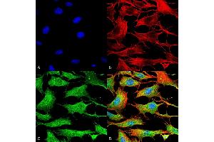 Immunocytochemistry/Immunofluorescence analysis using Mouse Anti-Copper Transporting ATPase 2 Monoclonal Antibody, Clone S62-29 . (ATP7B Antikörper  (AA 3-21) (FITC))