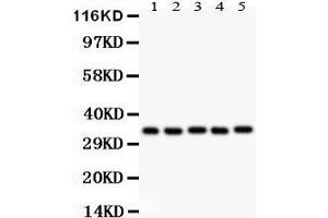 Western Blotting (WB) image for anti-Homeobox A11 (HOXA11) (AA 74-245) antibody (ABIN3042454) (Homeobox A11 Antikörper  (AA 74-245))