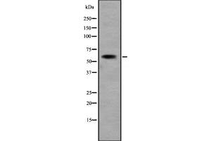 Western blot analysis of KCNN1 expression in Jurkat cell lysate ,The lane on the left is treated with the antigen-specific peptide. (KCNN1 Antikörper  (Internal Region))