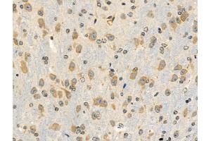 ABIN6258963 and ABIN6275058 at 1/100 staining Mouse brain tissue by IHC-P.