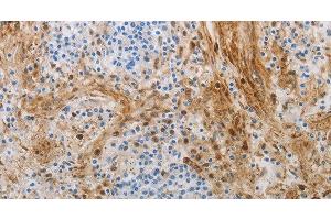 Immunohistochemistry of paraffin-embedded Human tonsil using NGFR Polyclonal Antibody at dilution of 1:50 (NGFR Antikörper)