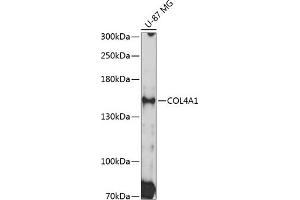 Western blot analysis of extracts of U-87 MG cells, using COL4 Antibody (0710) at 1:3000 dilution. (COL4A1 Antikörper  (AA 1445-1669))