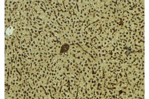 ABIN6278809 at 1/100 staining Mouse liver tissue by IHC-P.