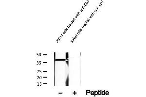 Western blot analysis of extracts of Jurkat cells treated with anti-CD3 , using Phospho-LAT (Tyr200) Antibody.