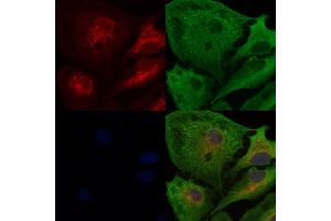 ABIN6262029 and ABIN6278157 staining  cells by IF/ICC.