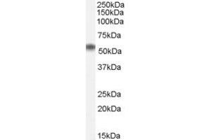 Western Blotting (WB) image for anti-ELMO/CED-12 Domain Containing 1 (ELMOD1) (N-Term) antibody (ABIN2156753) (ELMOD1 Antikörper  (N-Term))