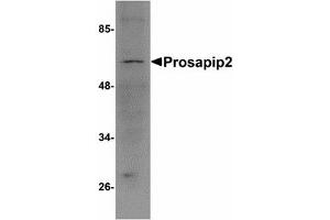 Image no. 1 for anti-TBK1 Binding Protein 1 (TBKBP1) (C-Term) antibody (ABIN478165) (TBKBP1 Antikörper  (C-Term))