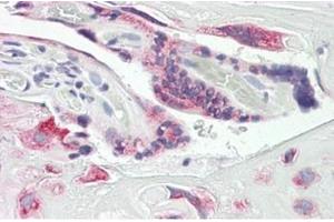 Human Placenta: Formalin-Fixed, Paraffin-Embedded (FFPE)