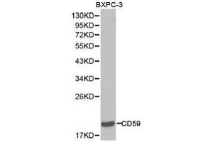 Western Blotting (WB) image for anti-CD59 (CD59) antibody (ABIN1871644) (CD59 Antikörper)
