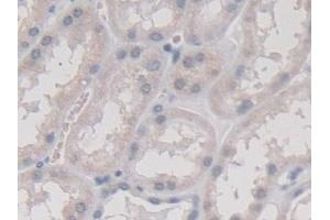 Detection of TMEM27 in Human Kidney Tissue using Monoclonal Antibody to Transmembrane Protein 27 (TMEM27) (TMEM27 Antikörper  (AA 17-137))