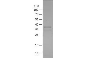 Western Blotting (WB) image for serpin Peptidase Inhibitor, Clade A (Alpha-1 Antiproteinase, Antitrypsin), Member 1 (SERPINA1) (AA 26-134) protein (His-IF2DI Tag) (ABIN7282027) (SERPINA1 Protein (AA 26-134) (His-IF2DI Tag))