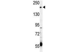TRPM6 antibody western blot analysis in CEM lysate (TRPM6 Antikörper  (AA 317-348))
