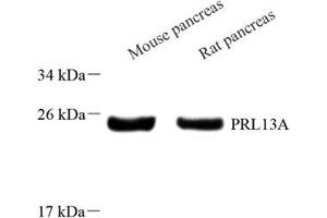 Western blot analysis of RPL13A (ABIN7075430) at dilution of 1: 800 (RPL13A Antikörper)