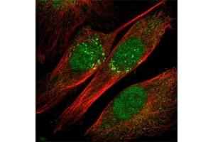 Immunofluorescence staining of U-251MG cell line with antibody shows positivity in nucleus and Golgi apparatus(green). (IL-18 Antikörper)