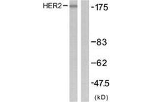Western blot analysis of extracts from SK-OV3 cells, using HER2 (Ab-1221/1222) Antibody. (ErbB2/Her2 Antikörper  (AA 1191-1240))