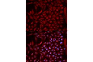 Immunofluorescence analysis of U2OS cells using CUL5 antibody (ABIN5973105). (Cullin 5 Antikörper)