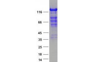 Validation with Western Blot (CARD11 Protein (Myc-DYKDDDDK Tag))