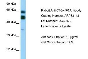 Western Blotting (WB) image for anti-Chromosome 16 Open Reading Frame 70 (C16orf70) (C-Term) antibody (ABIN2789391) (C16orf70 Antikörper  (C-Term))