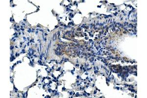 IHC analysis of Adam28 using anti-Adam28 antibody (ABIN7600945). (ADAM28 Antikörper  (AA 26-195))