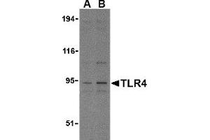 Western Blotting (WB) image for anti-Toll-Like Receptor 4 (TLR4) (N-Term) antibody (ABIN1031622) (TLR4 Antikörper  (N-Term))