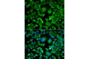 Immunofluorescence analysis of A549 cells using UBE2H antibody (ABIN4905537). (UBE2H Antikörper)