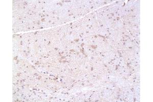 Formalin-fixed and paraffin embedded: rat brain tissue labeled with Anti-PMP22 Polyclonal Antibody, Unconjugated  at 1:200, followed by conjugation to the secondary antibody and DAB staining (PMP22 Antikörper  (AA 101-160))