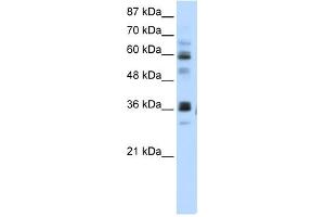 RPUSD2 antibody used at 5 ug/ml to detect target protein. (RPUSD2 Antikörper  (N-Term))