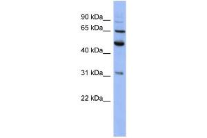 WB Suggested Anti-PSMD3 Antibody Titration: 0. (PSMD3 Antikörper  (N-Term))