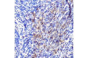 Immunohistochemistry (IHC) image for anti-Autophagy Related 10 (ATG10) (AA 1-220) antibody (ABIN6137243)