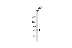 Anti-CTTNBP2NL Antibody (N-term) at 1:1000 dilution + ZR-75-1 whole cell lysate Lysates/proteins at 20 μg per lane. (CTTNBP2NL Antikörper  (N-Term))
