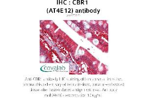 Image no. 1 for anti-Carbonyl Reductase 1 (CBR1) antibody (ABIN1724380) (CBR1 Antikörper)