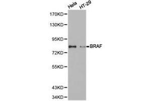Western Blotting (WB) image for anti-B-Raf proto-oncogene, serine/threonine kinase (BRAF) antibody (ABIN1871340) (BRAF Antikörper)