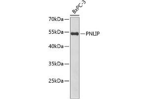 Western blot analysis of extracts of BxPC-3 cells, using PNLIP antibody  at 1:1000 dilution. (PNLIP Antikörper  (AA 166-465))