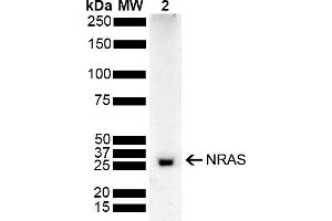 Western blot analysis of Rat Kidney showing detection of 21.