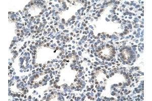 anti-Solute Carrier Family 10 (Sodium/bile Acid Cotransporter Family), Member 5 (SLC10A5) antibody