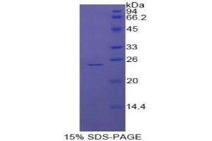 SDS-PAGE (SDS) image for Glutathione S-Transferase pi 1 (GSTP1) (AA 1-210) protein (His tag) (ABIN1079721) (GSTP1 Protein (AA 1-210) (His tag))