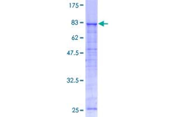 ATP6V1A Protein (AA 1-617) (GST tag)