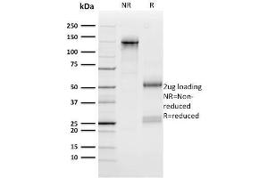 SDS-PAGE Analysis Purified n-Myc Mouse Monoclonal Antibody (NMYC-1). (MYCN Antikörper)