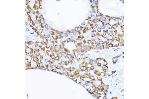 Immunohistochemistry (IHC) image for anti-Sorting and Assembly Machinery Component 50 Homolog (SAMM50) (AA 1-220) antibody (ABIN1682619)